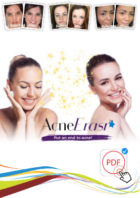 Acne Erasr System PDF EBOOK